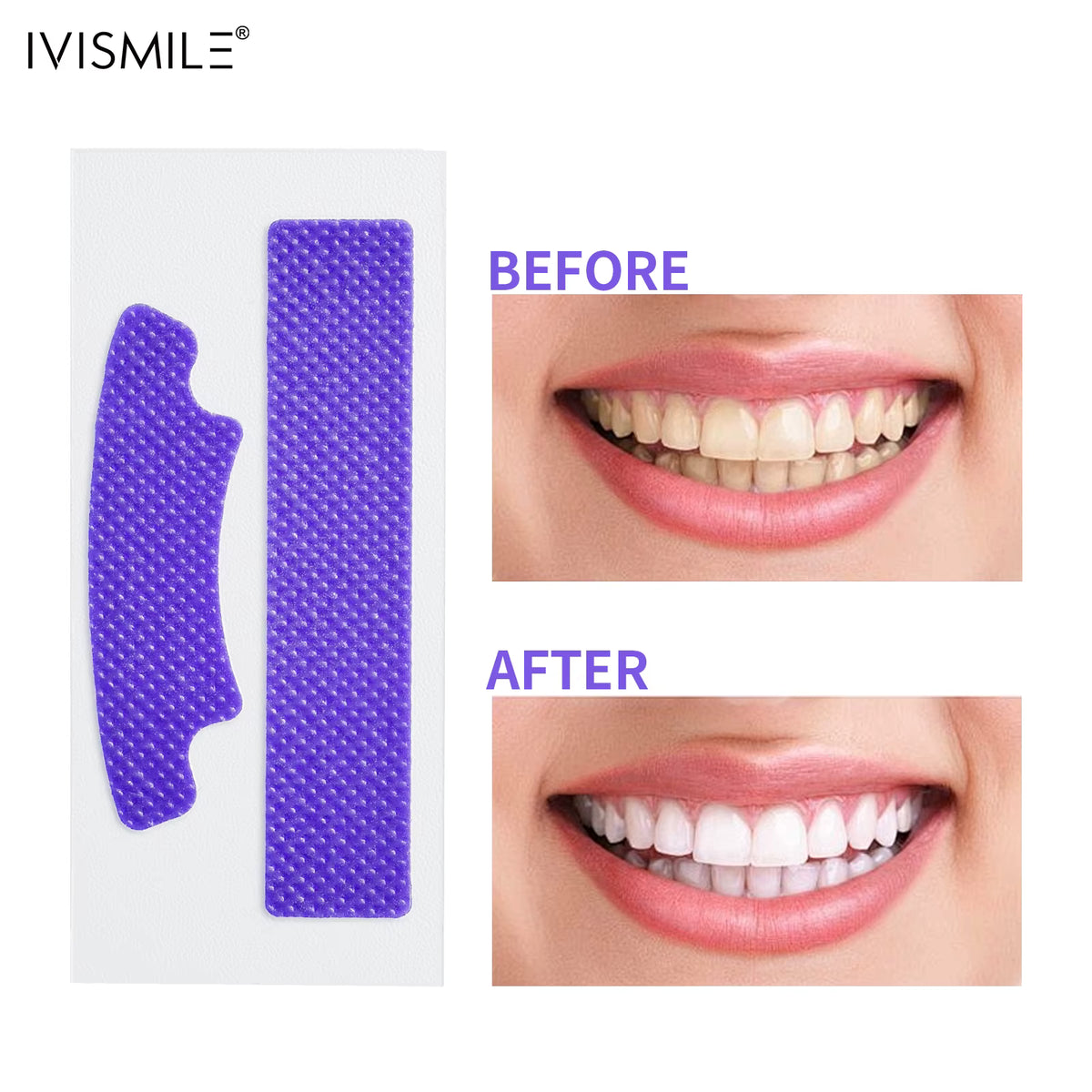 Bandes Blanchissantes Violettes – Résultat en 30 min